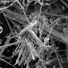 fibras del mineral de asbestos, vistas con microscopio electrnico.